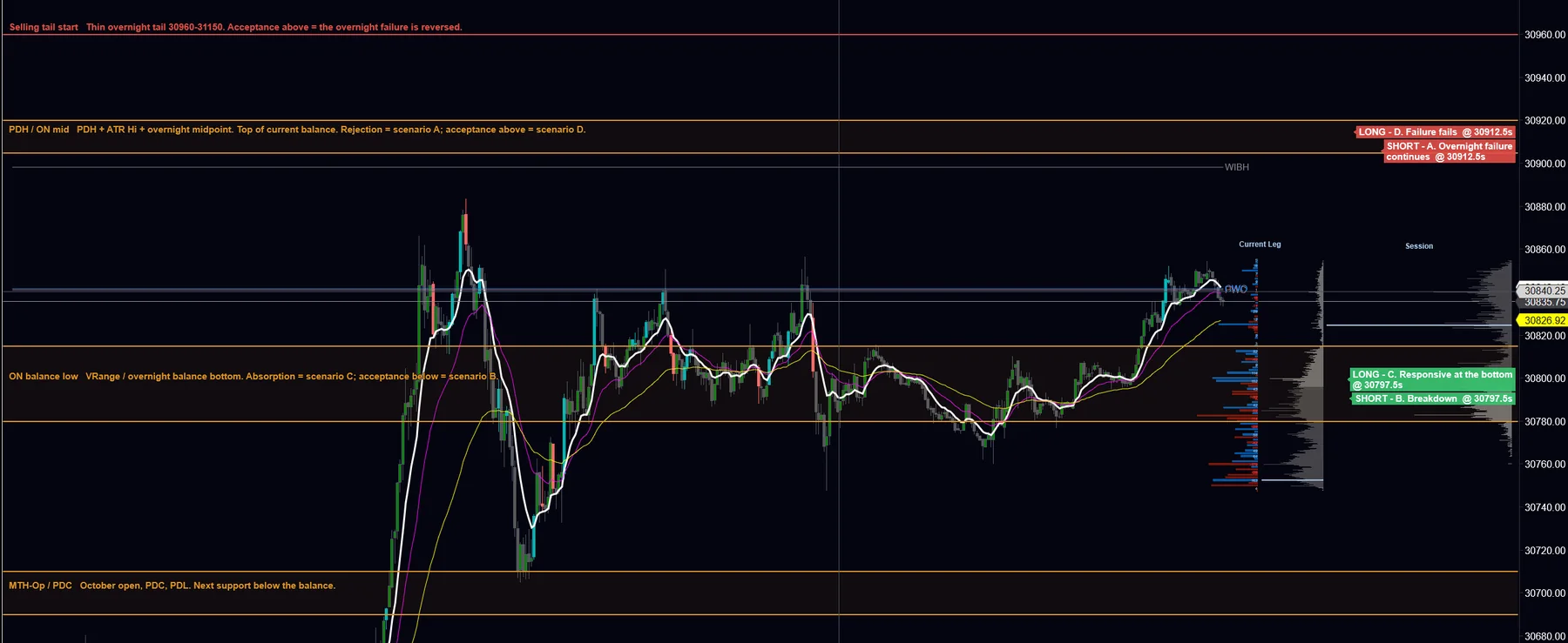 A NinjaTrader chart with the day's plan drawn on it: the overnight balance, the prior day's high and the monthly open as shaded zones with notes, and four scenario triggers on the right: Long D, Short A, Long C and Short B with their prices.